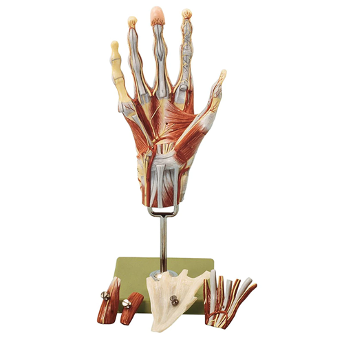 Upper Extremities